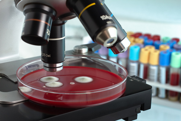 Können Pilze die Wärmedämmung revolutionieren?